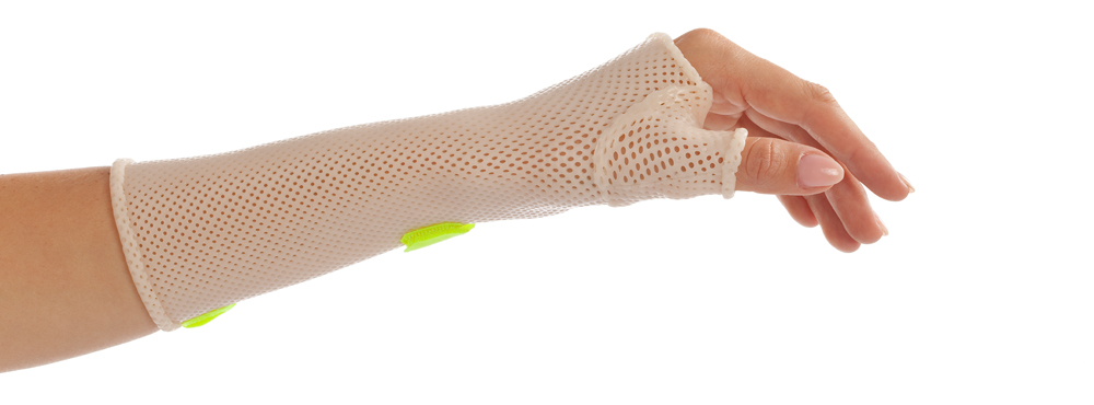 Thumb Immobilization Orthosis with Orfit Classic