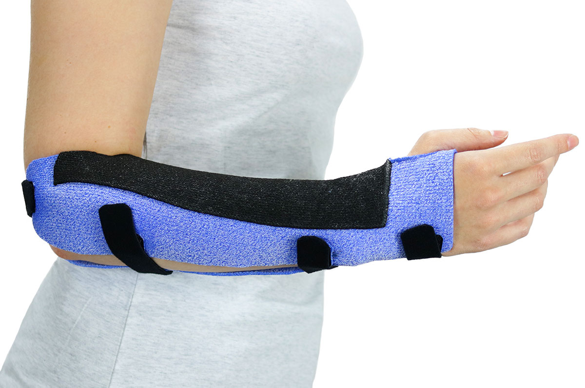 Arm with a black and blue colored Muenster Orthosis in Orficast More 30 cm.