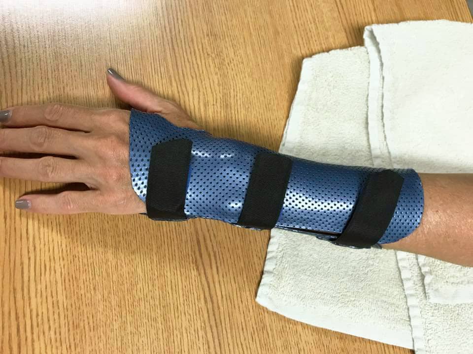 The fifth splinting principle is to avoid pressure points in the orthosis.