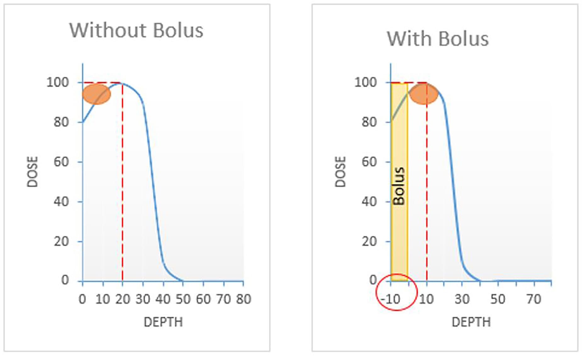 Diagram describing the difference between use and no use of thermoplastic bolus.