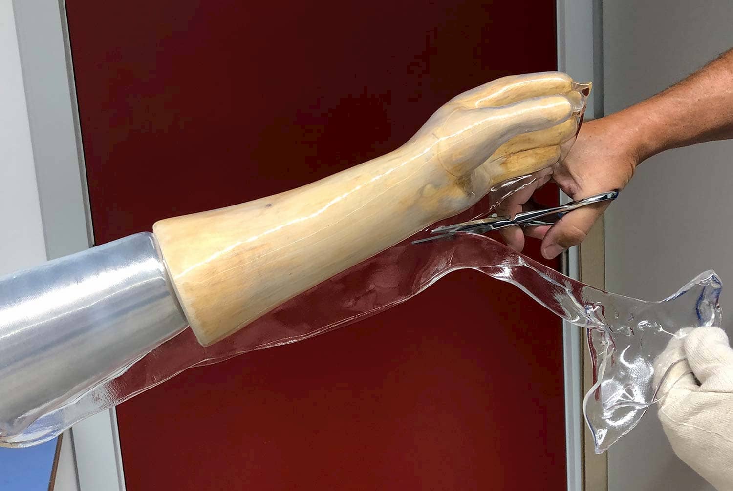 Trimming excess material of a high-temperature orthosis