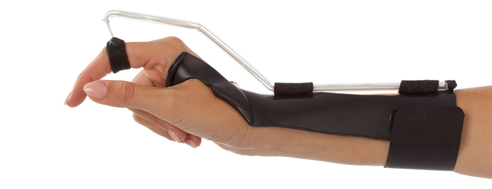 Extensor tendon mobilization orthosis with Dynasyst Orfitube.