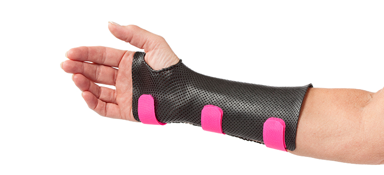 The Circumferential Wrist Orthosis