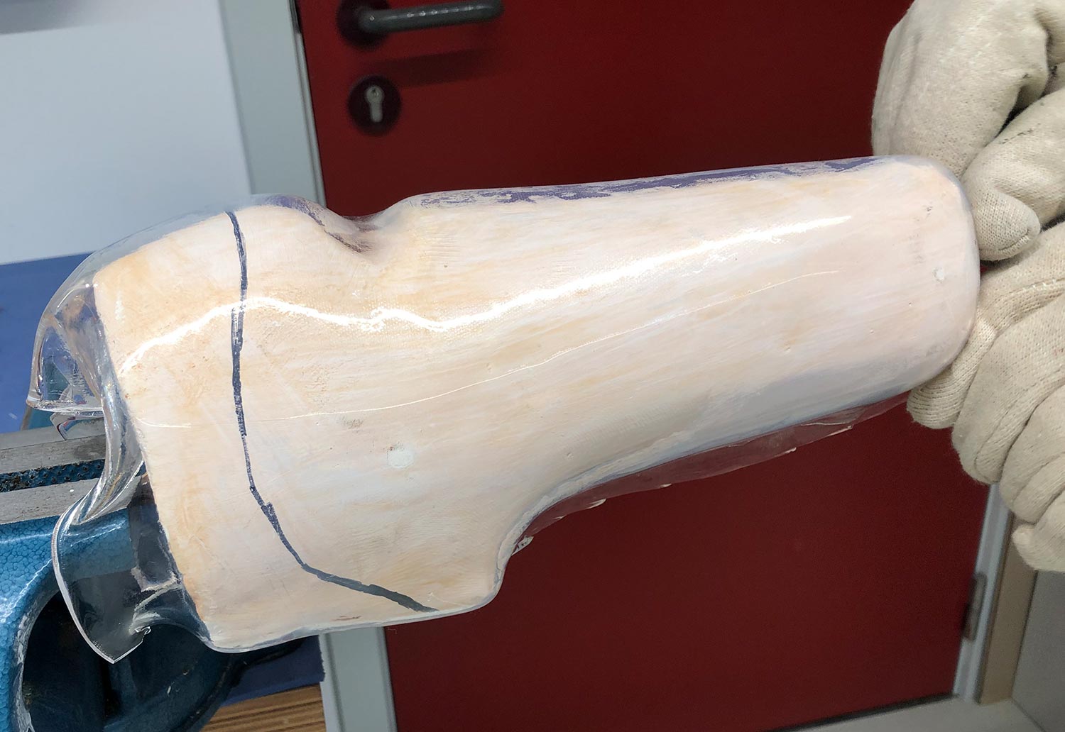 Two gloved hands moulding a transtibial prosthetic socket.