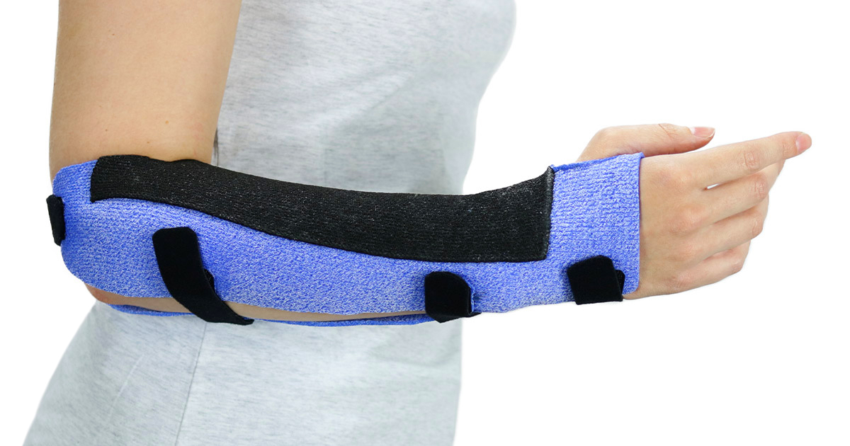 Arm with a black and blue colored Muenster Orthosis in Orficast More 30 cm.