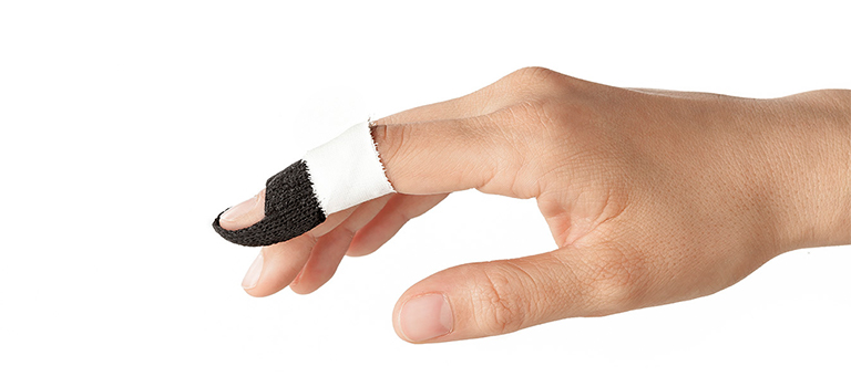 Splinting Options for Treating a Mallet Finger